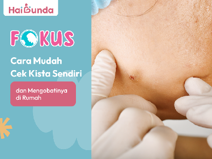 Cara Mudah Cek Kista Sendiri dan Mengobatinya di Rumah