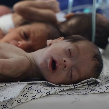 PBB Peringatkan 14 Ribu Bayi di Gaza Bisa Tewas dalam 48 Jam karena Kelaparan