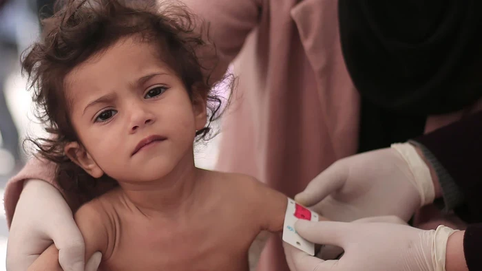 PBB Peringatkan 14 Ribu Bayi di Gaza Bisa Tewas dalam 48 Jam karena Kelaparan