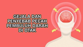 INFOGRAFIS: Gejala dan Penyebab Pecah Pembuluh Darah di Otak