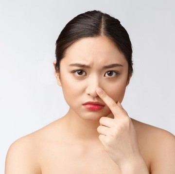 Kenapa Jerawat Sering Muncul di Area Hidung? Yuk, Cari Tahu Penyebabnya!