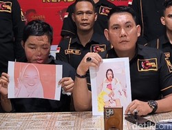 Curhat Suryani Disiram Air Keras Suami Siri, Minta Pelaku Segera Ditangkap