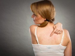 Stevens-Johnson Syndrome (SJS)