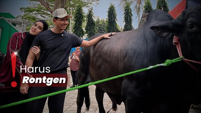 Sonny Septian soal Kondisi Terbaru Fairuz usai Kaki Diinjak Sapi 1,2 Ton