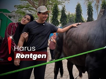 img-title Sonny Septian soal Kondisi Terbaru Fairuz usai Kaki Diinjak Sapi 1,2 Ton