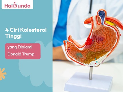 4 Ciri Kolesterol Tinggi Seperti yang Dialami Donald Trump