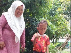 Kisah Si Kecil Aufan Derita Hidrosefalus, Crouzon Syndrome hingga Spina Bifida