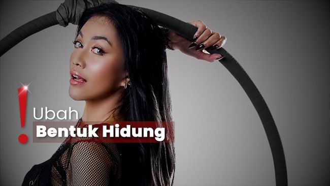 Penampilan Terbaru Denada usai Rhinoplasty di Bangkok, Thailand