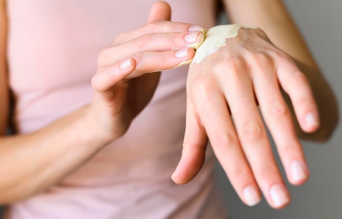 Ilustrasi penanganan luka bakar/Freepik: freepik