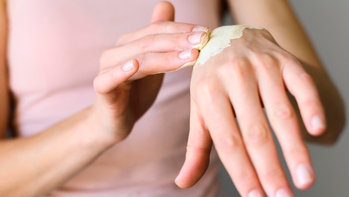 6 Cara Mengatasi Kulit Melepuh Akibat Terkena Setrika Panas
