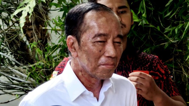Jokowi didoakan cepat sembuh oleh warga yang mendatangi rumahnya untuk merayakan ulang tahun ke-64.