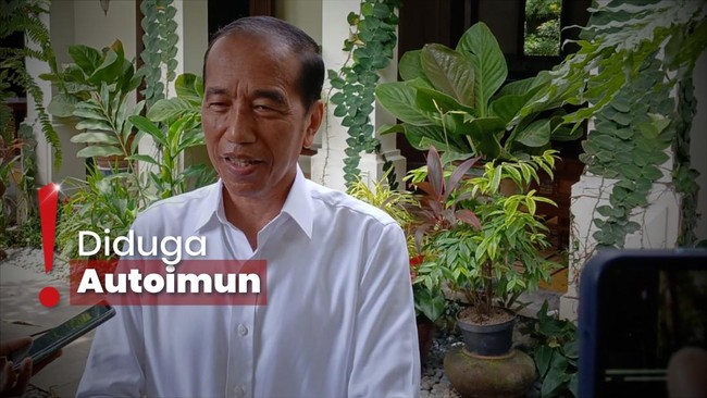 Kondisi Kesehatan Jokowi Dibongkar Ajudan, Apa Hanya Alergi?