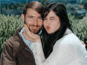 Stephanie Poetri Disebut Alami Kosmemophobia, Fobia terhadap Perhiasan