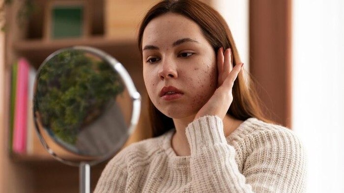 img-title 5 Cara Memilih Skincare yang Aman untuk Kulit Sensitif agar Tidak Gampang Breakout