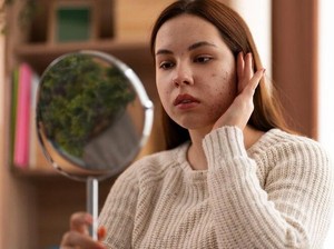 5 Cara Memilih Skincare yang Aman untuk Kulit Sensitif agar Tidak Gampang Breakout