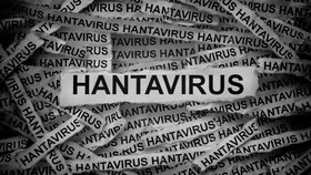 WHO Lacak Hanta Virus di Pesawat Usai Wabah di Kapal Pesiar