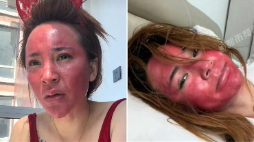 Nasib Wanita yang Tak Hapus Make Up Selama 22 Tahun, Wajahnya Berubah Jadi...