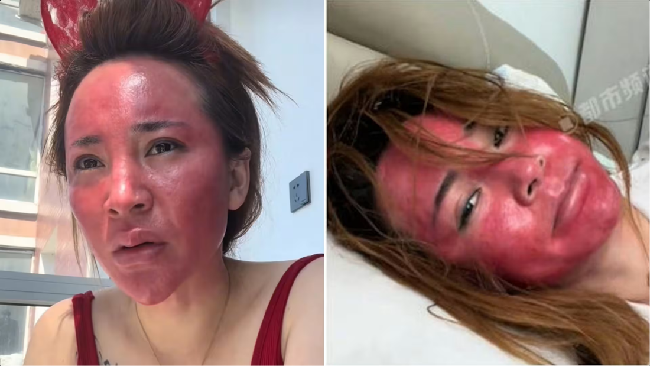 Nasib Wanita yang Tak Hapus Make Up Selama 22 Tahun, Wajahnya Berubah Jadi...