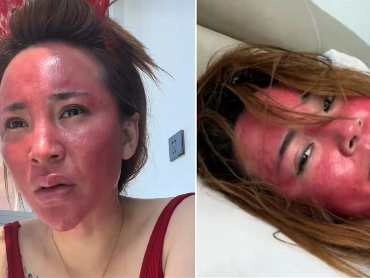 img-title Nasib Wanita yang Tak Hapus Make Up Selama 22 Tahun, Wajahnya Berubah Jadi...