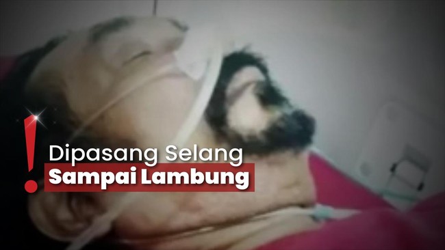 Hamdan ATT Meninggal, Sempat Berjuang Melawan Sakit Stroke-Ginjal