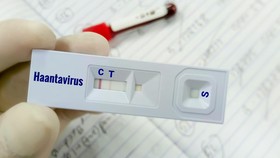 Kemenkes Temukan 8 Kasus Virus Hanta, Waspadai Penularannya