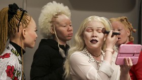 FOTO: Melawan Stigma Albino Lewat Kontes Kecantikan