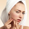 7 Bahan Alami untuk Mengatasi Jerawat Hormonal