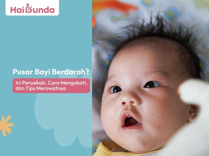 Pusar Bayi Berdarah? Ini Penyebab, Cara Mengobati, dan Tips Merawatnya