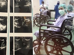 Cerita Wanita di Jaktim Kena Kanker Usus di Usia 20, Keluhkan Nyeri Perut Seperti Ini