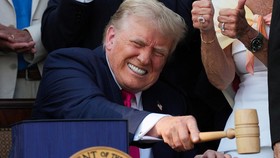 Donald Trump Didiagnosis Insufisiensi Vena Kronis, Apa Penyebabnya?