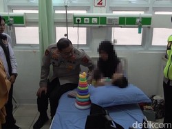 Kondisi Terkini Balita Korban Penganiayaan Ayah Kejam di Purwakarta