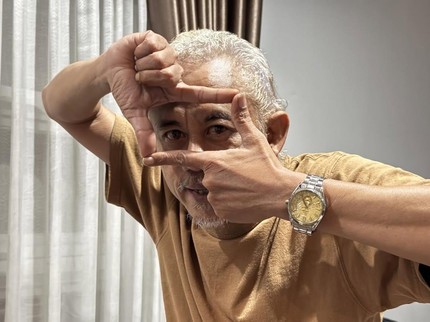 Ketahui Penyumbatan Pembuluh Darah Batang Otak yang Dialami Epy Kusnandar Sebelum Meninggal