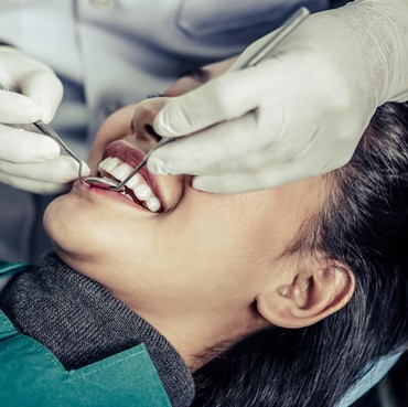 Daftar Perawatan Gigi yang Tidak Ditanggung BPJS Kesehatan