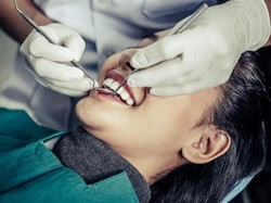 Daftar Perawatan Gigi yang Tidak Ditanggung BPJS Kesehatan