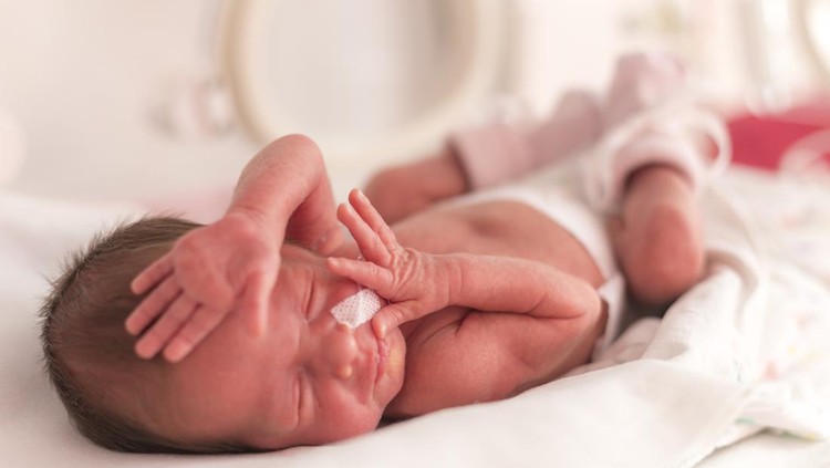 Merawat kulit bayi prematur