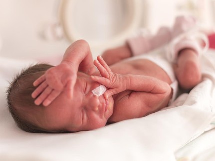 5 Cara Perawatan Kulit Bayi Prematur, Bunda Perlu Tahu