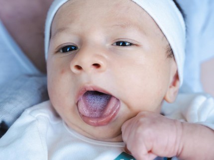 Jangan Sepelekan Bercak Putih di Mulut Bayi, Ketahui Penyebab dan Cara Mengatasinya
