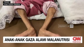 VIDEO: Anak-Anak Gaza Alami Malnutrisi
