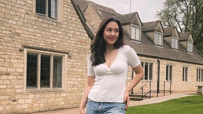 Deretan Artis Didiagnosis Skoliosis hingga Harus Tahan Sakit, Sherina hingga Jessica Mila