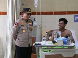 Polda Kaltara Janji Tanggung Biaya Perawatan Mahasiswa Korban Luka Bakar