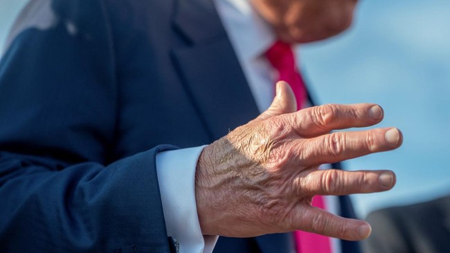 Spekulasi soal kesehatan Presiden AS Donald Trump menarik perhatian setelah memar di tangan yang berusaha ditutupi terlihat jelas saat ia tampil di muka publik.