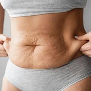 3 Cara Menghindari Kulit Bergelambir saat Menurunkan Berat Badan