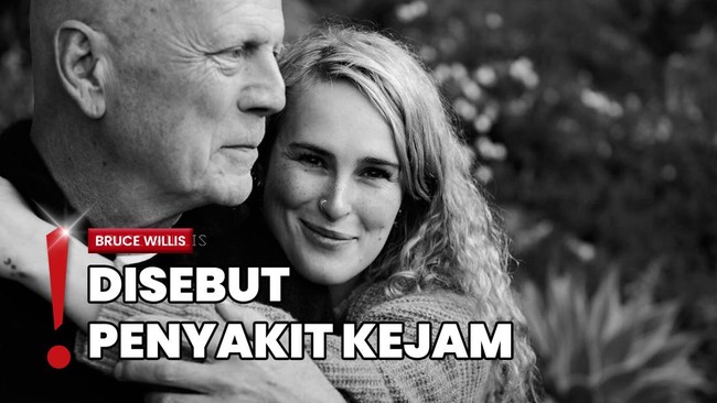 Bruce Willis Makin Parah, Demensia Bikin Sulit Bicara dan Baca