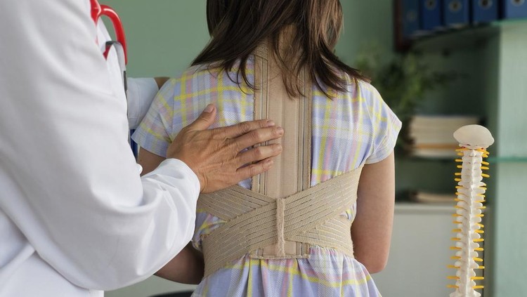 Mengenal Vertebral Body Tethering (VBT), Inovasi Terkini dalam Penanganan Skoliosis pada Anak