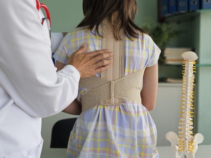 Mengenal Vertebral Body Tethering (VBT), Inovasi Terkini dalam Penanganan Skoliosis Anak