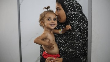 Cerita Pilu Anak Kelaparan di Gaza: Mau ke Surga, Ada Makanan di Sana