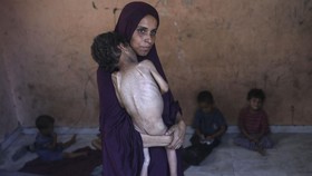 FOTO: Anak-anak Korban Genosida Sistematis Israel, Dibuat Kelaparan