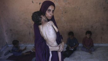 FOTO: Anak-anak Korban Genosida Sistematis Israel, Dibuat Kelaparan