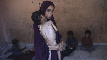 Izrael obtožen sistematičnega izstradovanja palestinskih otrok v Gazi