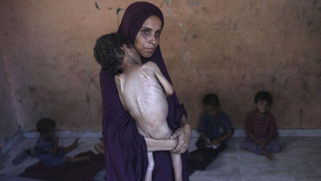 Bertambah Lagi Korban Tewas Akibat Kelaparan di Gaza Kementerian Kesehatan Gaza melaporkan pada, Selasa (12/8) lima orang tewas karena malnutrisi imbas pembatasan ketat Israel terkait bantuan kemanusiaan.